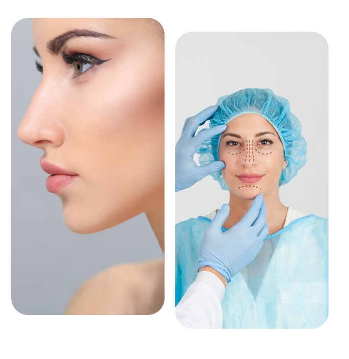 plastic surgery